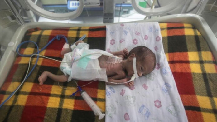 gaza_hunger